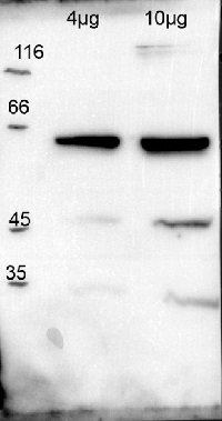 HXK1 | Hexokinase 1 in the group Antibodies Plant/Algal / Plant Developmental Biology / Plant Signal Transduction at Agrisera AB (Antibodies for research) (AS12 2601)